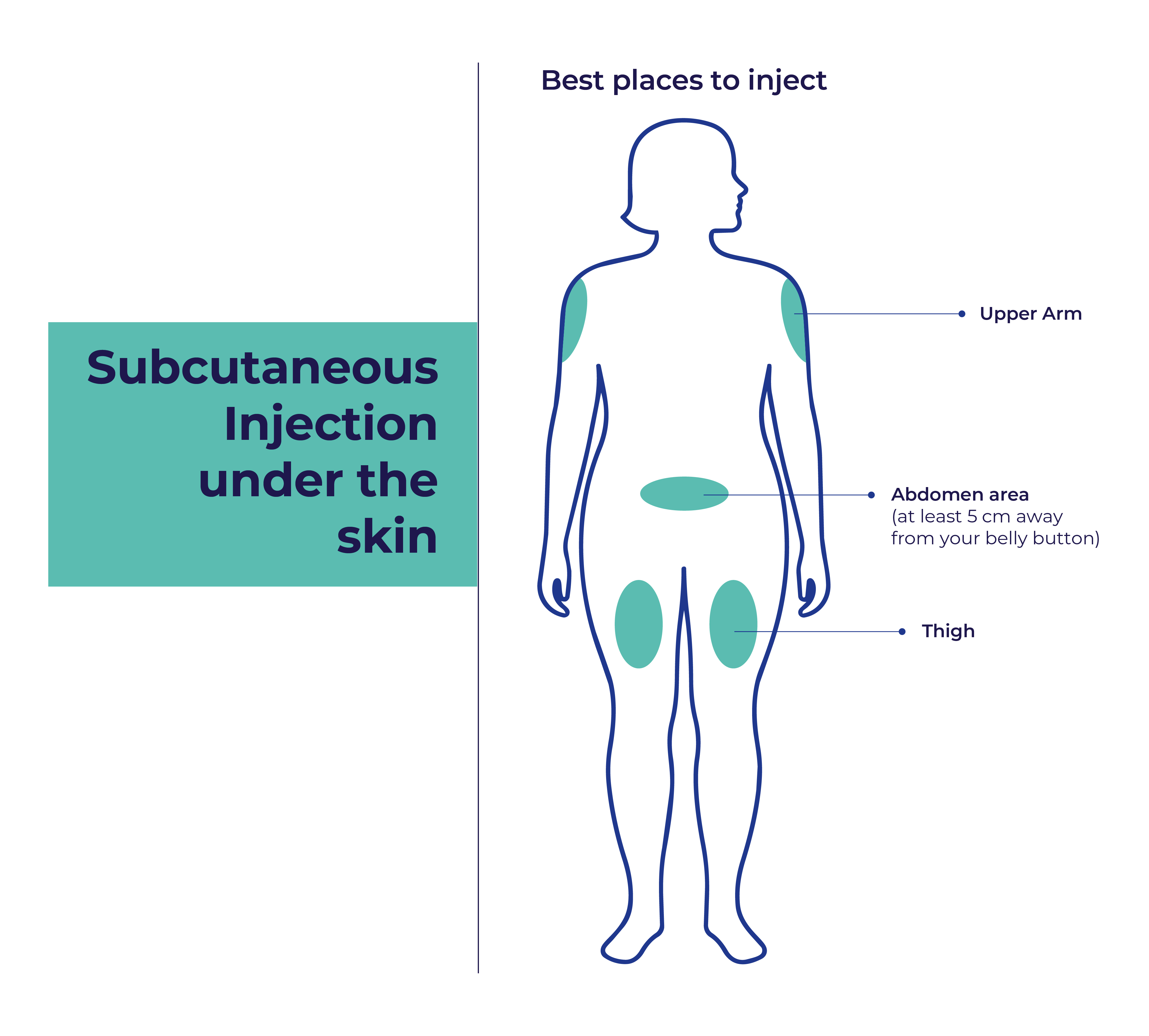 Best places to inject Semawin subcutaneously: upper arm, abdomen at least 5 cm from the belly button, and thigh